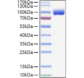 SDS-PAGE - Recombinant Human PIGR Protein (C-terminal His Tag) (A331174) - Antibodies.com