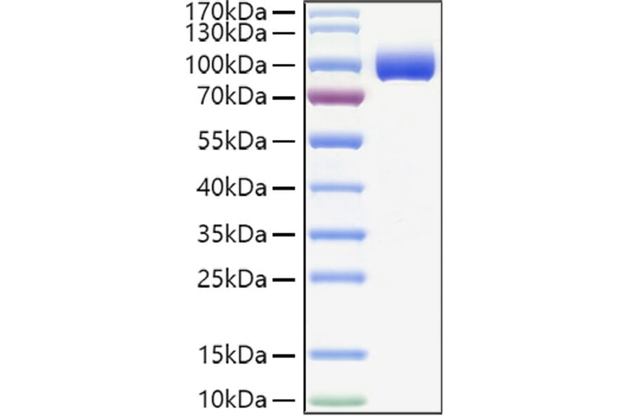 SDS-PAGE - Recombinant Human PIGR Protein (C-terminal His Tag) (A331174) - Antibodies.com