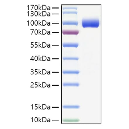 SDS-PAGE - Recombinant Human PIGR Protein (C-terminal His Tag) (A331174) - Antibodies.com