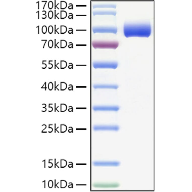 SDS-PAGE - Recombinant Human PIGR Protein (C-terminal His Tag) (A331174) - Antibodies.com