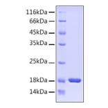 SDS-PAGE - Recombinant Human PIN1 Protein (A331175) - Antibodies.com