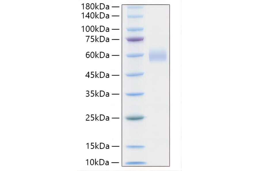 SDS-PAGE - Recombinant Human PLA2G7 Protein (C-terminal His Tag) (A331177) - Antibodies.com