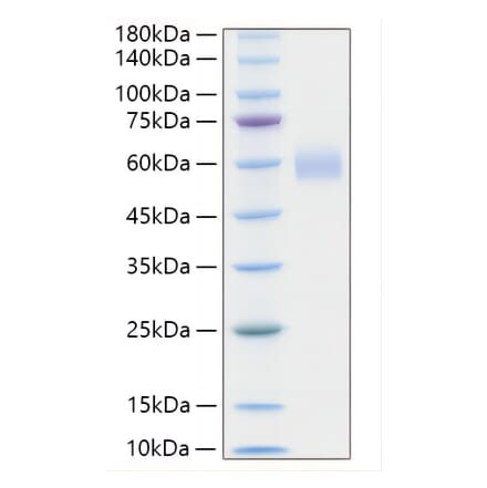 SDS-PAGE - Recombinant Human PLA2G7 Protein (C-terminal His Tag) (A331177) - Antibodies.com