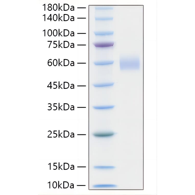 SDS-PAGE - Recombinant Human PLA2G7 Protein (C-terminal His Tag) (A331177) - Antibodies.com
