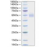 SDS-PAGE - Recombinant Human PLA2G7 Protein (C-terminal His Tag) (A331177) - Antibodies.com