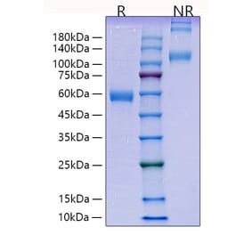 SDS-PAGE - Recombinant Human PLGF Protein (C-terminal Human Fc Tag) (A331178) - Antibodies.com