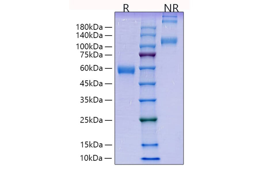 SDS-PAGE - Recombinant Human PLGF Protein (C-terminal Human Fc Tag) (A331178) - Antibodies.com