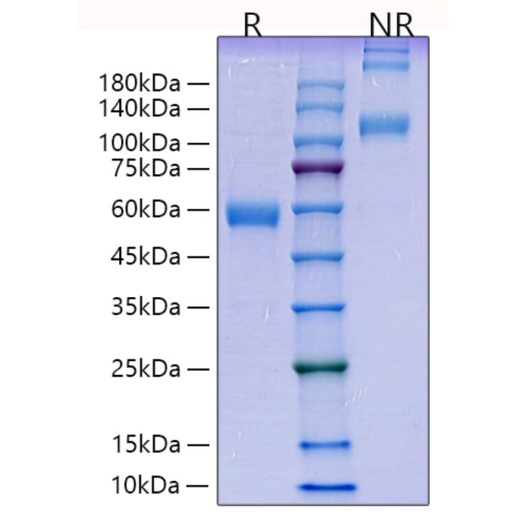 SDS-PAGE - Recombinant Human PLGF Protein (C-terminal Human Fc Tag) (A331178) - Antibodies.com
