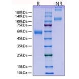 SDS-PAGE - Recombinant Human PLGF Protein (C-terminal Human Fc Tag) (A331178) - Antibodies.com