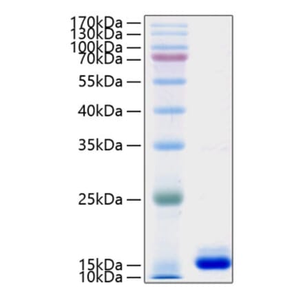 SDS-PAGE - Recombinant Human PMP2 Protein (N-terminal His Tag) (A331179) - Antibodies.com