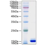 SDS-PAGE - Recombinant Human PMP2 Protein (N-terminal His Tag) (A331179) - Antibodies.com
