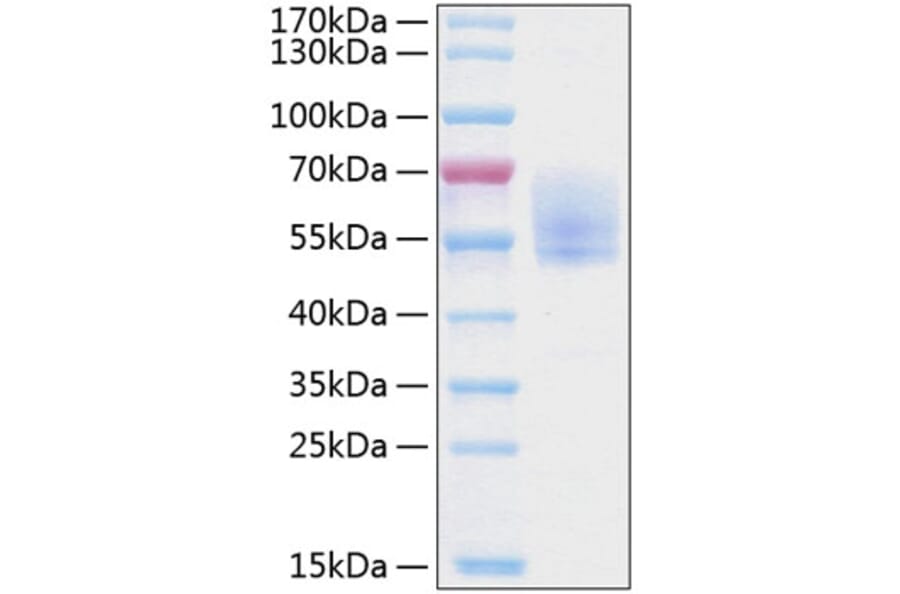 SDS-PAGE - Recombinant Human Podoplanin Protein (C-terminal Human Fc and His Tag) (A331180) - Antibodies.com