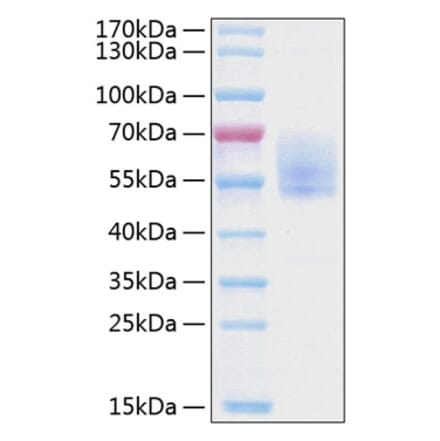 SDS-PAGE - Recombinant Human Podoplanin Protein (C-terminal Human Fc and His Tag) (A331180) - Antibodies.com