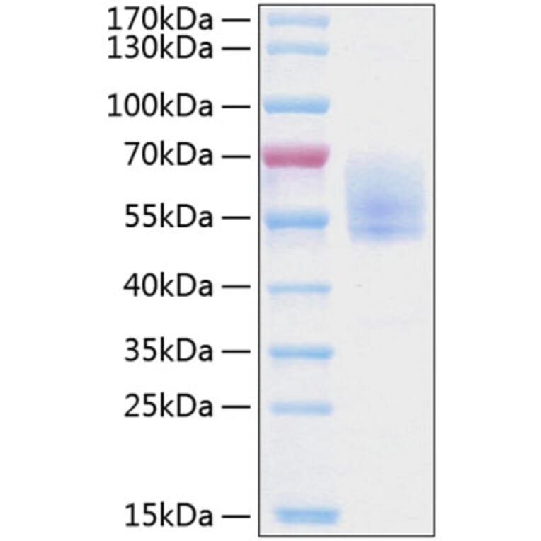 SDS-PAGE - Recombinant Human Podoplanin Protein (C-terminal Human Fc and His Tag) (A331180) - Antibodies.com