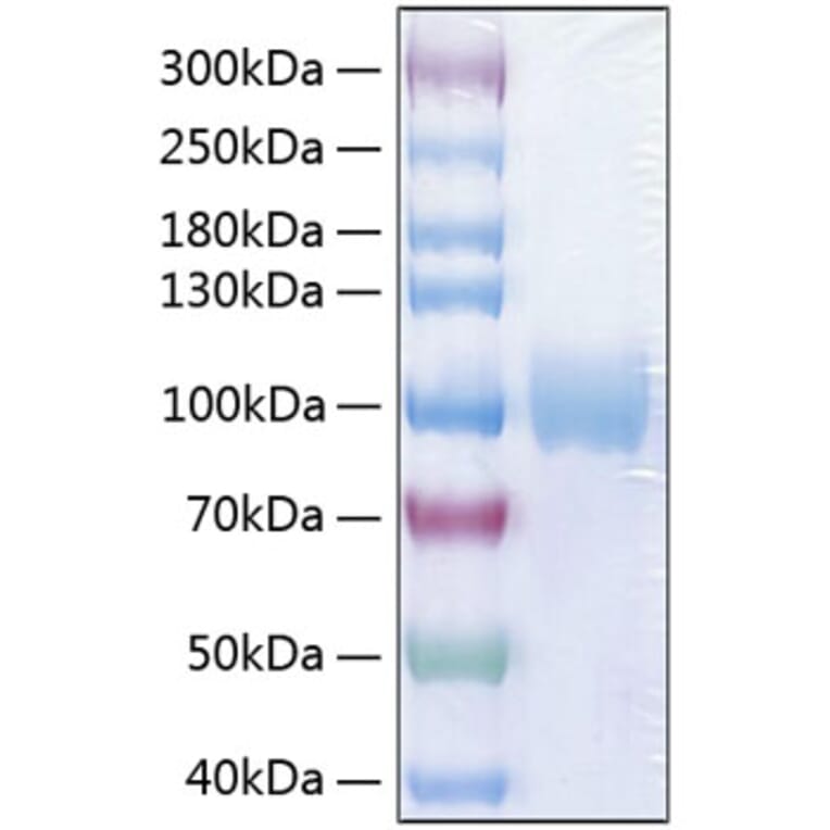 SDS-PAGE - Recombinant Human Poliovirus Receptor/PVR Protein (C-terminal Human Fc and His Tag) (A331181) - Antibodies.com