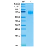 Tris-Bis PAGE - Recombinant Human Poliovirus Receptor/PVR Protein (Biotin) (C-terminal His and Avi Tag) (A331182) - Antibodies.com