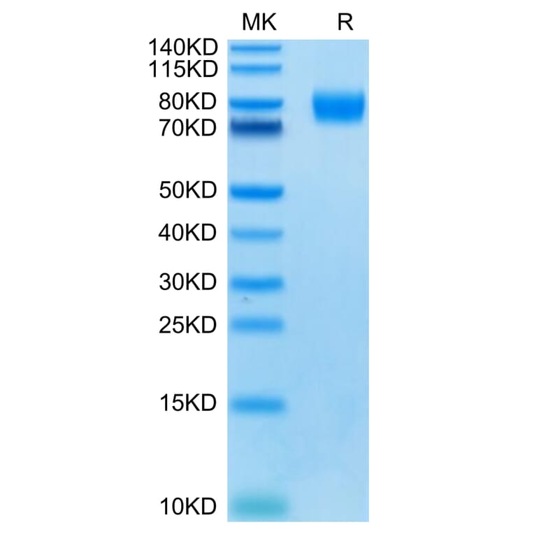 Tris-Bis PAGE - Recombinant Human Poliovirus Receptor/PVR Protein (C-terminal Mouse Fc Tag) (A331184) - Antibodies.com