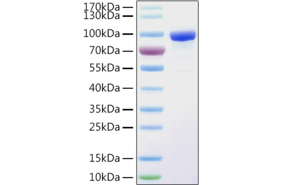 SDS-PAGE - Recombinant Human PPAR gamma Protein (N-terminal His and GST Tag) (A331186) - Antibodies.com