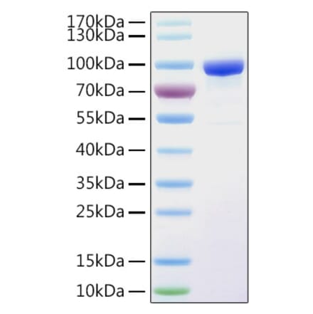 SDS-PAGE - Recombinant Human PPAR gamma Protein (N-terminal His and GST Tag) (A331186) - Antibodies.com