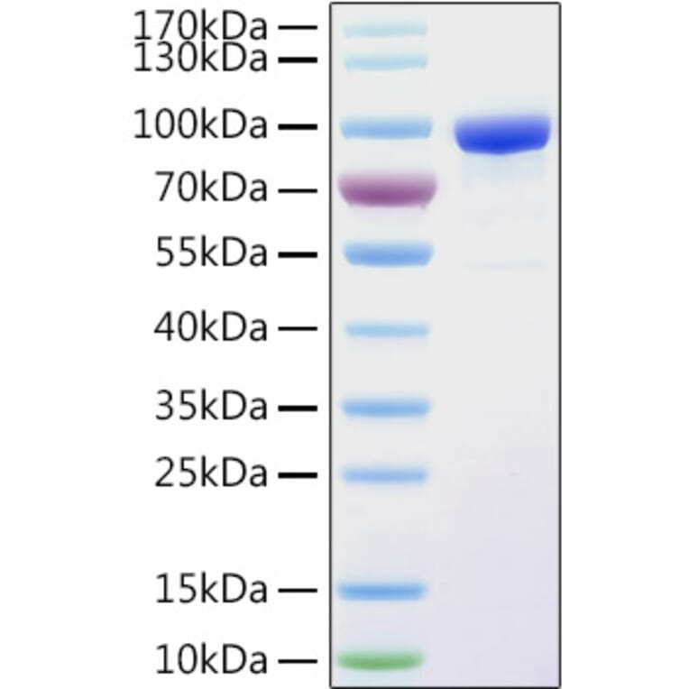 SDS-PAGE - Recombinant Human PPAR gamma Protein (N-terminal His and GST Tag) (A331186) - Antibodies.com