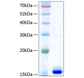 SDS-PAGE - Recombinant Human Prealbumin Protein (C-terminal His Tag) (A331187) - Antibodies.com