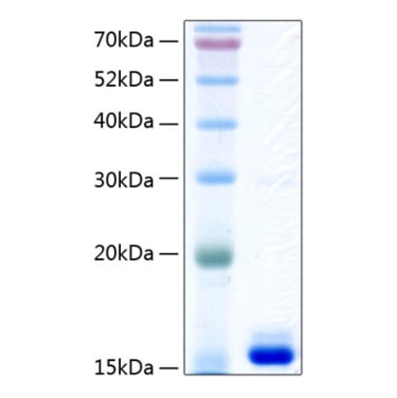 SDS-PAGE - Recombinant Human Prealbumin Protein (C-terminal His Tag) (A331187) - Antibodies.com