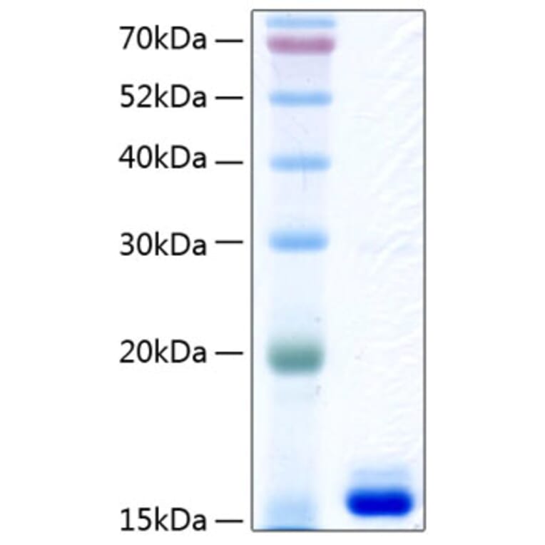 SDS-PAGE - Recombinant Human Prealbumin Protein (C-terminal His Tag) (A331187) - Antibodies.com