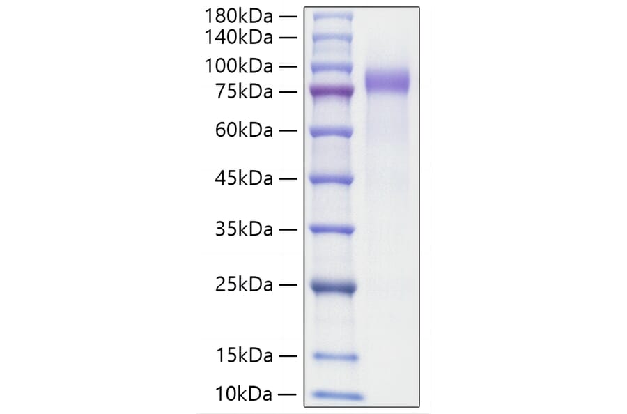 SDS-PAGE - Recombinant Human Progranulin Protein (C-terminal His Tag) (A331188) - Antibodies.com