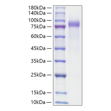 SDS-PAGE - Recombinant Human Progranulin Protein (C-terminal His Tag) (A331188) - Antibodies.com