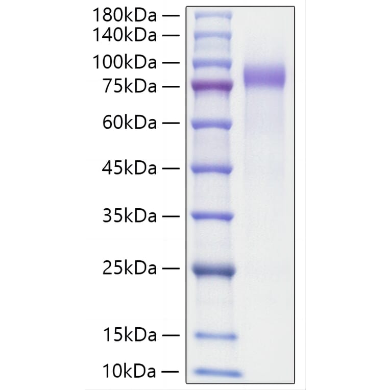 SDS-PAGE - Recombinant Human Progranulin Protein (C-terminal His Tag) (A331188) - Antibodies.com