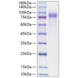 SDS-PAGE - Recombinant Human Progranulin Protein (C-terminal His Tag) (A331188) - Antibodies.com