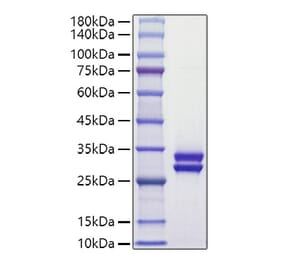 SDS-PAGE - Recombinant Human Prolactin Protein (C-terminal His Tag) (A331189) - Antibodies.com