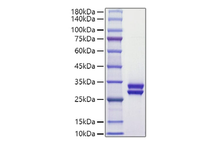 SDS-PAGE - Recombinant Human Prolactin Protein (C-terminal His Tag) (A331189) - Antibodies.com