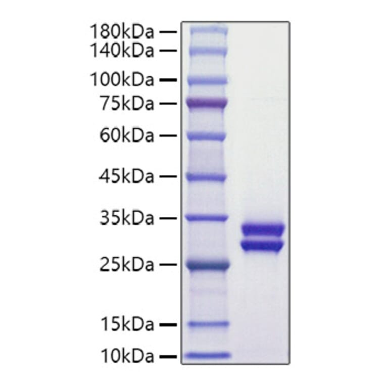 SDS-PAGE - Recombinant Human Prolactin Protein (C-terminal His Tag) (A331189) - Antibodies.com