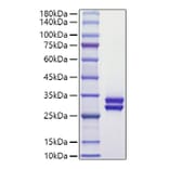 SDS-PAGE - Recombinant Human Prolactin Protein (C-terminal His Tag) (A331189) - Antibodies.com
