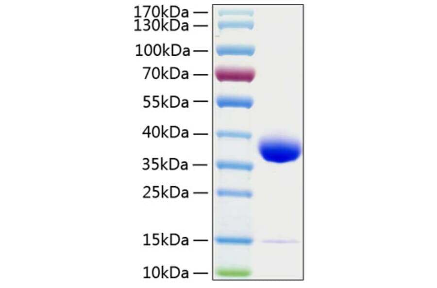SDS-PAGE - Recombinant Human Prolactin Receptor Protein (C-terminal His Tag) (A331190) - Antibodies.com