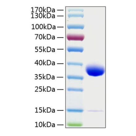 SDS-PAGE - Recombinant Human Prolactin Receptor Protein (C-terminal His Tag) (A331190) - Antibodies.com
