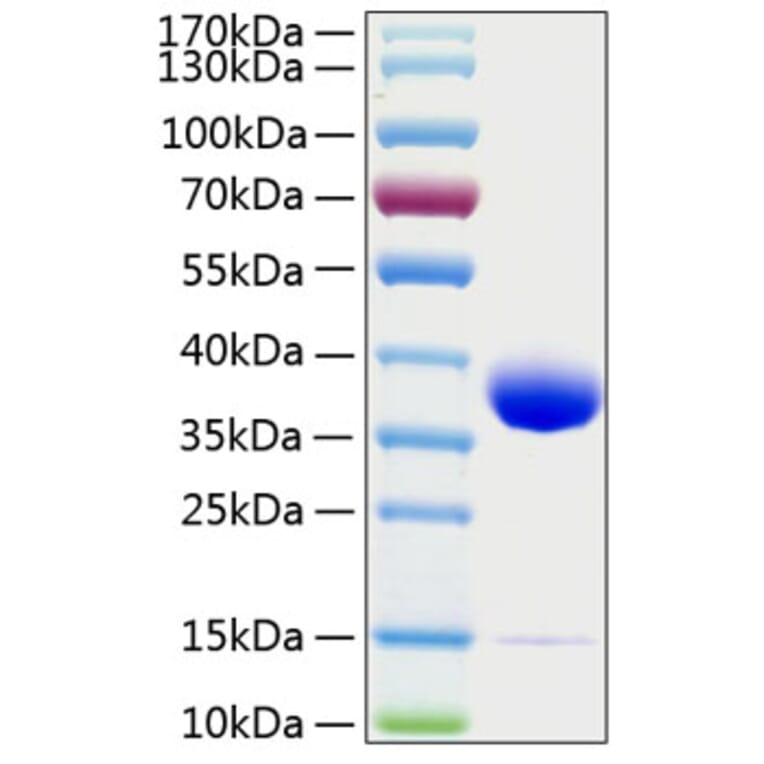SDS-PAGE - Recombinant Human Prolactin Receptor Protein (C-terminal His Tag) (A331190) - Antibodies.com