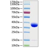 SDS-PAGE - Recombinant Human Prolactin Receptor Protein (C-terminal His Tag) (A331190) - Antibodies.com