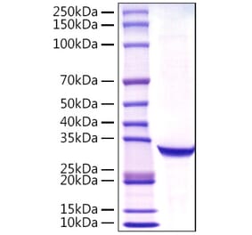 SDS-PAGE - Recombinant Human Prostate Specific Antigen Protein (C-terminal His Tag) (A331191) - Antibodies.com