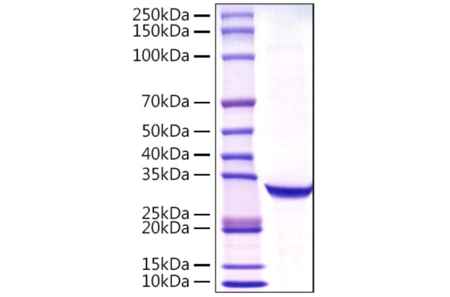 SDS-PAGE - Recombinant Human Prostate Specific Antigen Protein (C-terminal His Tag) (A331191) - Antibodies.com