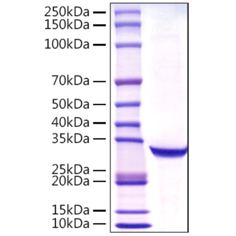 SDS-PAGE - Recombinant Human Prostate Specific Antigen Protein (C-terminal His Tag) (A331191) - Antibodies.com