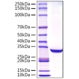 SDS-PAGE - Recombinant Human Prostate Specific Antigen Protein (C-terminal His Tag) (A331191) - Antibodies.com
