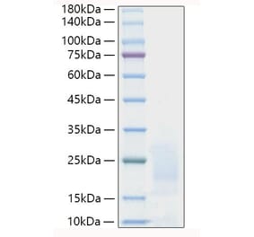 SDS-PAGE - Recombinant Human PSCA Protein (C-terminal His Tag) (A331192) - Antibodies.com