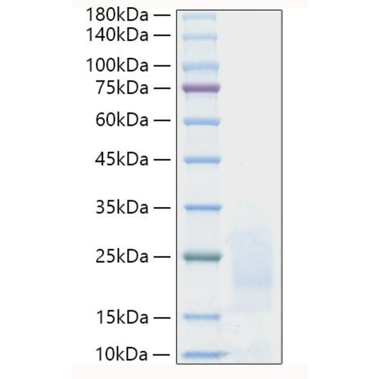 SDS-PAGE - Recombinant Human PSCA Protein (C-terminal His Tag) (A331192) - Antibodies.com
