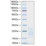 SDS-PAGE - Recombinant Human PSCA Protein (C-terminal His Tag) (A331192) - Antibodies.com