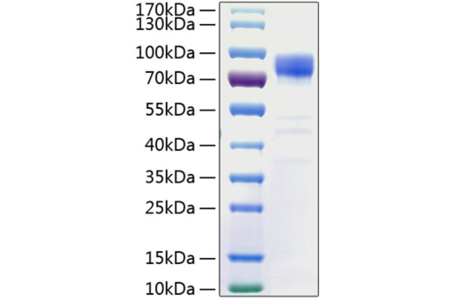 SDS-PAGE - Recombinant Human PSD95 Protein (N-terminal His Tag) (A331193) - Antibodies.com