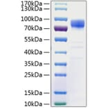 SDS-PAGE - Recombinant Human PSD95 Protein (N-terminal His Tag) (A331193) - Antibodies.com