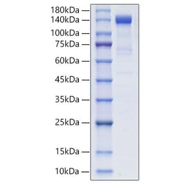 SDS-PAGE - Recombinant Human PSMA Protein (N-terminal Human Fc Tag) (A331194) - Antibodies.com