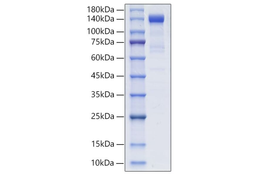SDS-PAGE - Recombinant Human PSMA Protein (N-terminal Human Fc Tag) (A331194) - Antibodies.com
